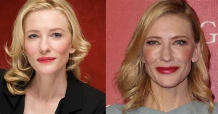 Cate Blanchett Facelift Plastic Surgery Before and After