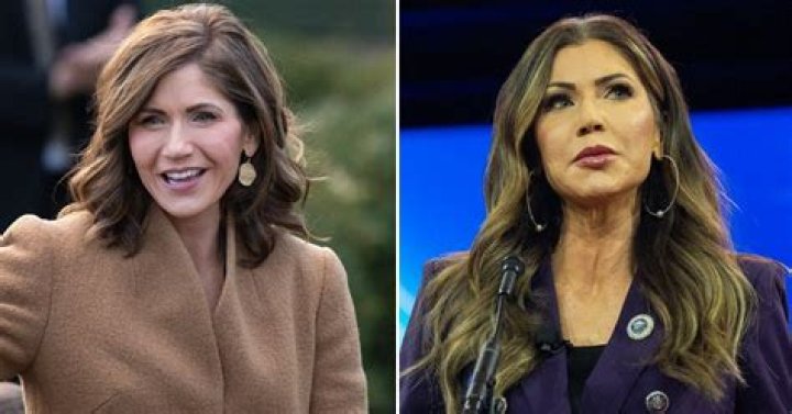 Kristi Noem Plastic Surgery: What Are Some Possible Procedures?