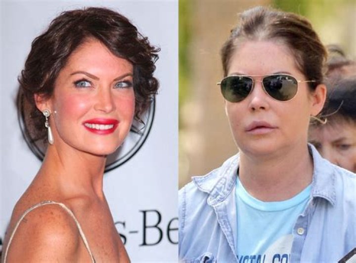 Lara Flynn Boyle Plastic Surgery Before and After