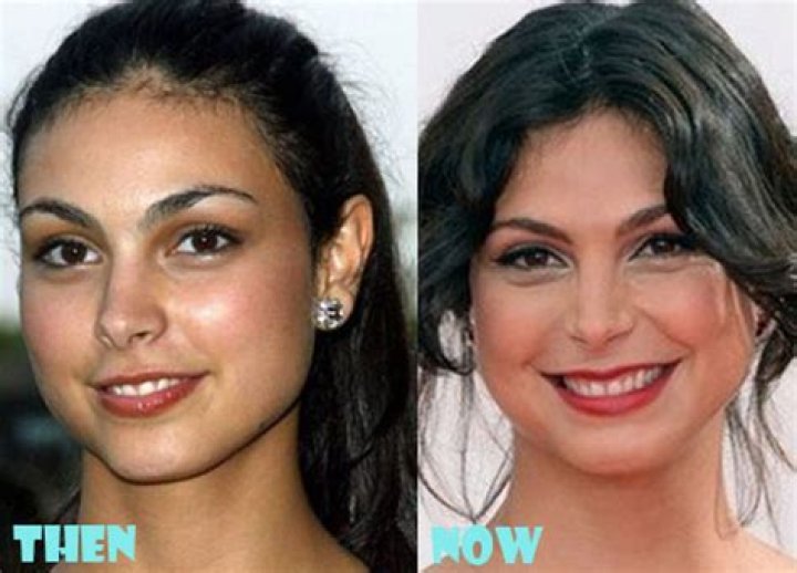 Morena Baccarin Nose Job Plastic Surgery Before and After